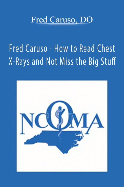 How to Read Chest X–Rays and Not Miss the Big Stuff – Fred Caruso