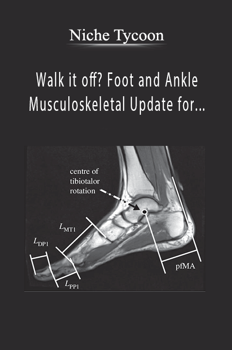 Walk it off? Foot and Ankle Musculoskeletal Update for Primary Care – Nicholas A. Cheney