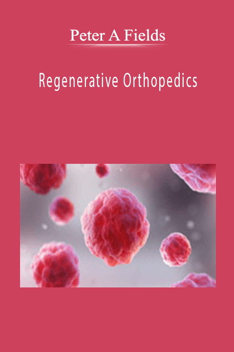 Regenerative Orthopedics: Non–surgical Repair with Stem Cells/PRP/Prolotherapy+ – Peter A Fields