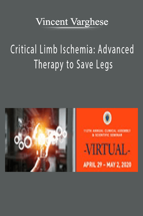 Critical Limb Ischemia: Advanced Therapy to Save Legs – Vincent Varghese